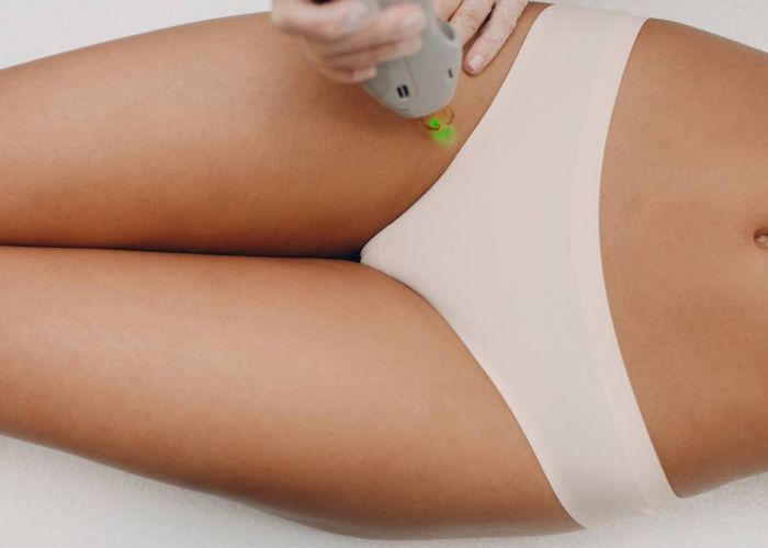 Behandlungszone Intimbereich & Po-  Moderne Laserbehandlung zur effektiven Haarentfernung im Lissera Laserzentrum Stuttgart