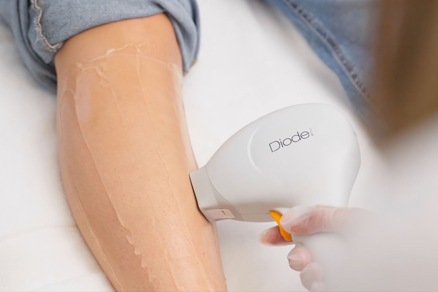 Alles was du über Laser Haarentfernung im Lissera Laserzentrum Stuttgart wissen musst!