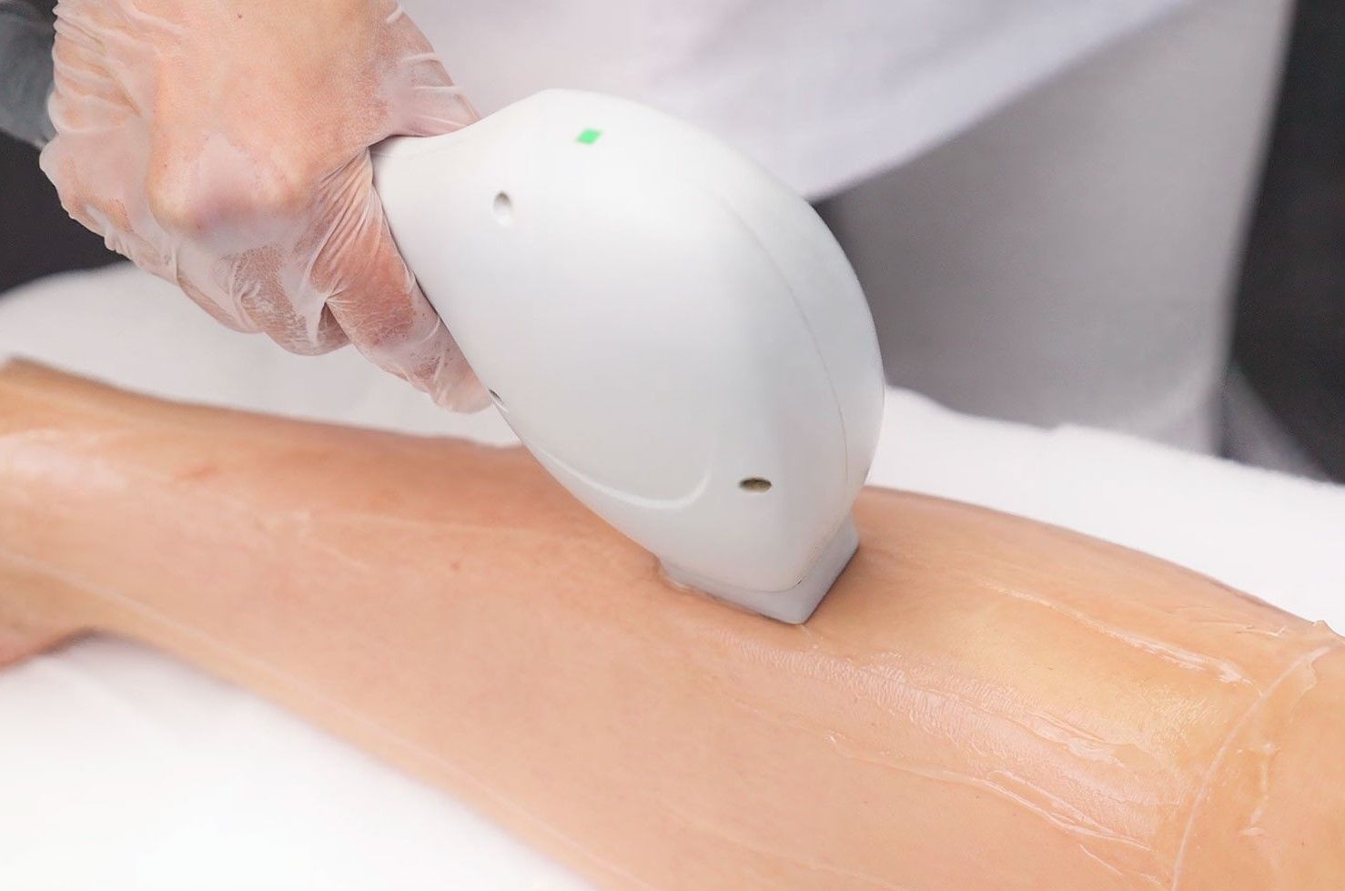 Behandlungen & Preise - Moderne Laser Haarentfernung im Lissera Laserzentrum Stuttgart